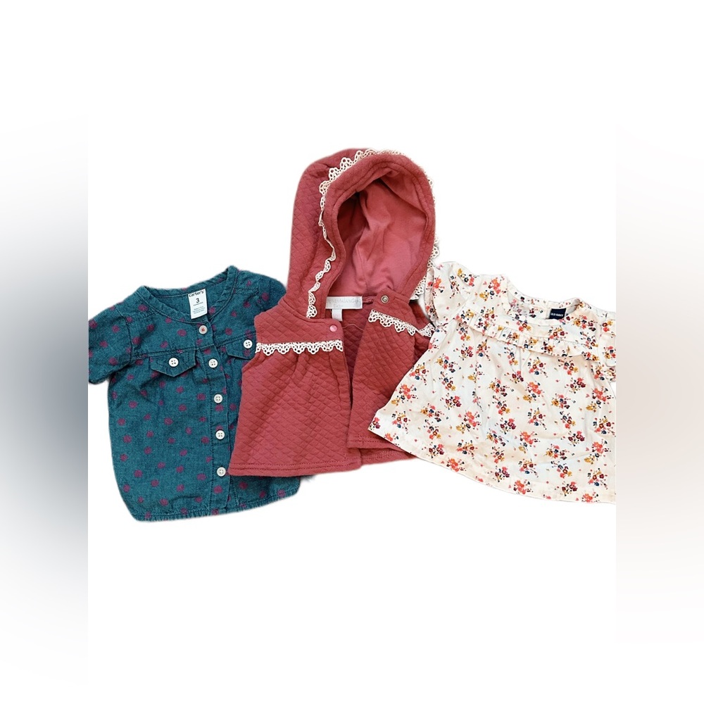 Baby Girl Mixed Top Bundle 0-3mo